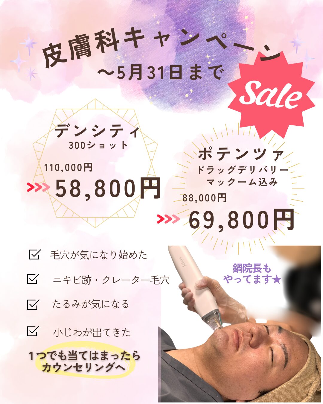 5月はデンシティやポテンツァがお得！