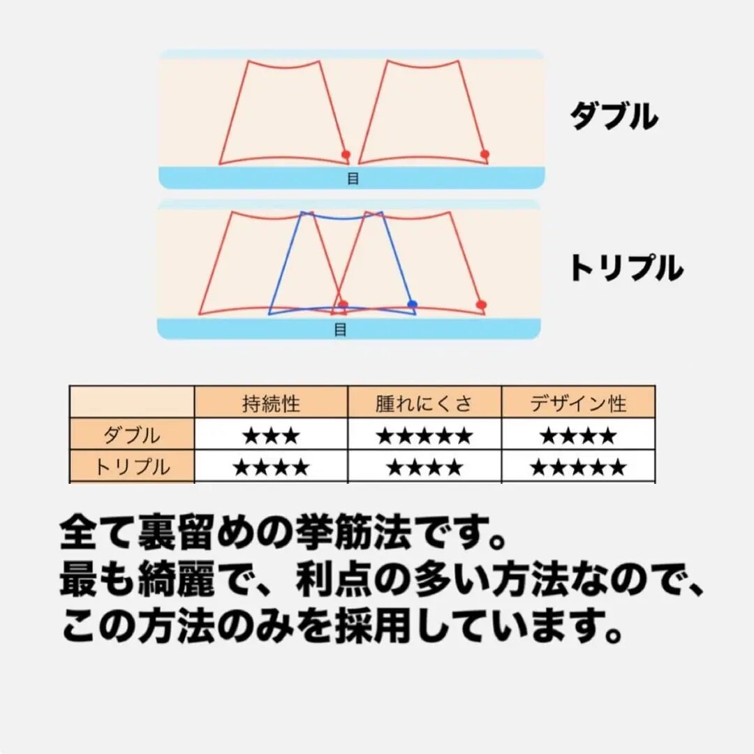 二重整形埋没法の種類