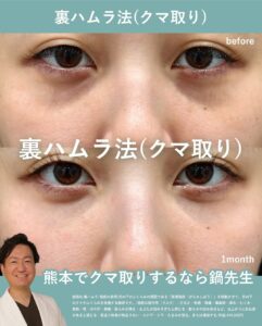 裏ハムラって、何でしょう？のメイン画像