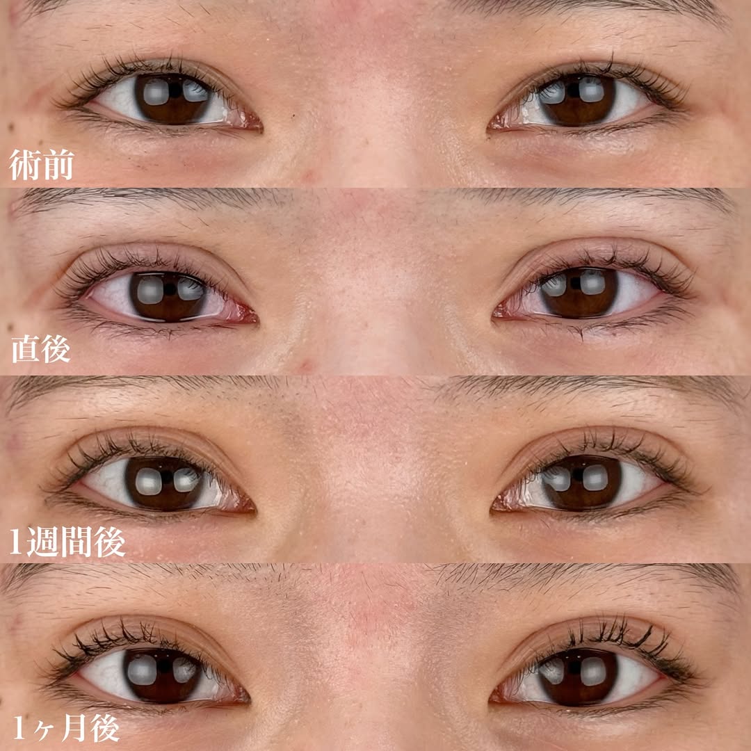 埋没法NABEトリプル