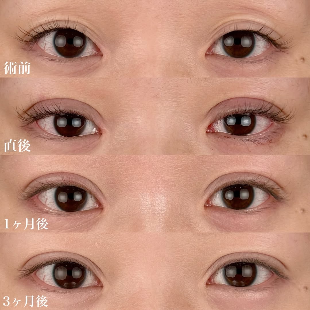 埋没法NABEトリプル2